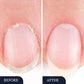 ✨NOVIDADE 2026🔥 Caneta Antifúngica para Unhas dos Pés Danificadas | 50% DE DESCONTO! 🎉