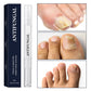 ✨NOVIDADE 2026🔥 Caneta Antifúngica para Unhas dos Pés Danificadas | 50% DE DESCONTO! 🎉