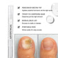 ✨NOVIDADE 2026🔥 Caneta Antifúngica para Unhas dos Pés Danificadas | 50% DE DESCONTO! 🎉