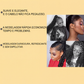 🧴💎 Gel para tranças e Locs – fixação duradoura, sem caspa & natural! ✨